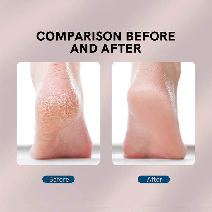 Electric Foot Filer